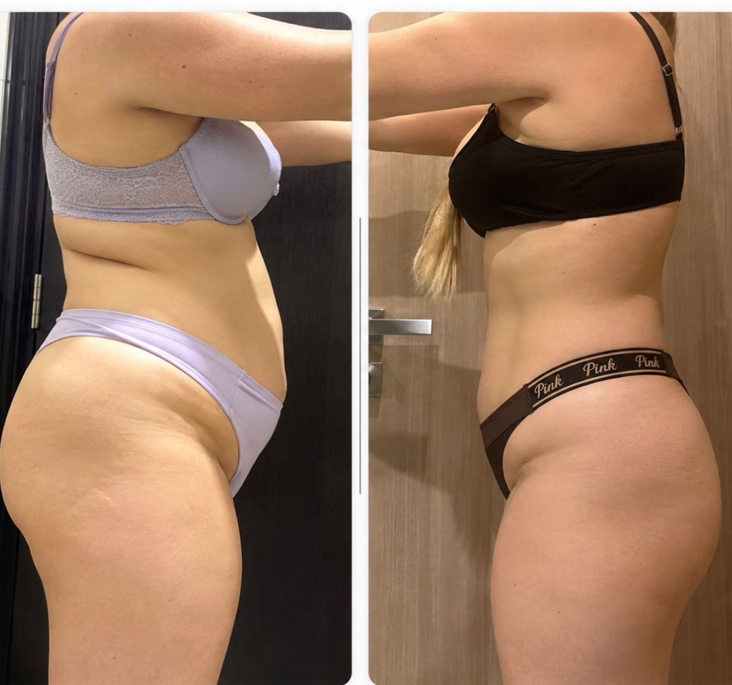 Anonymous before-and-after transformation