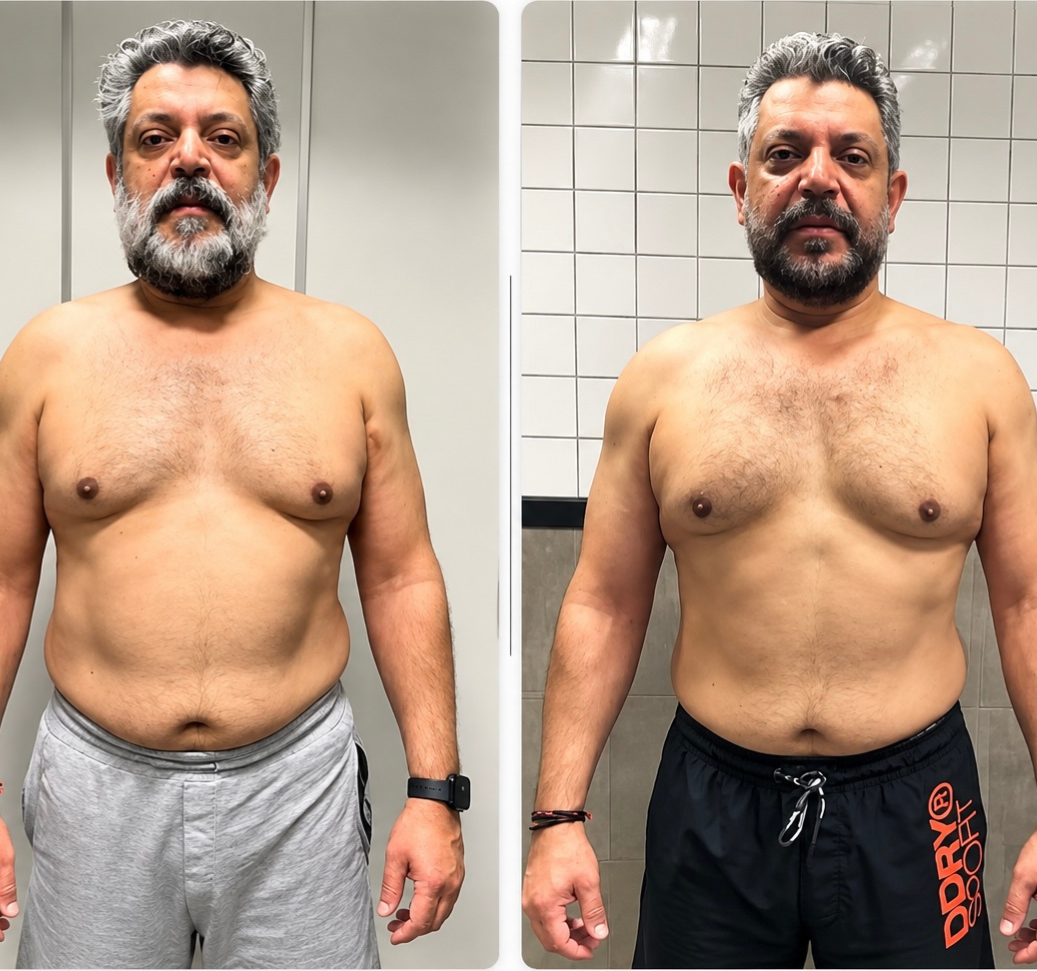 Rakesh before-and-after transformation